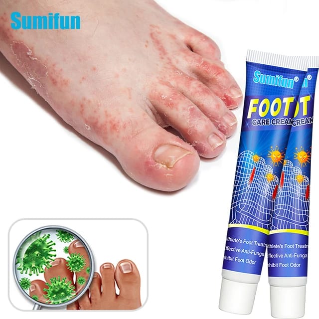 Crema antibacterial para pies